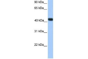 WB Suggested Anti-SSBP4 Antibody Titration:  0.