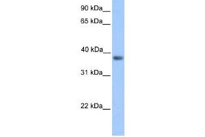 Image no. 1 for anti-Neurogenic Differentiation 6 (NEUROD6) (Middle Region) antibody (ABIN2779630)