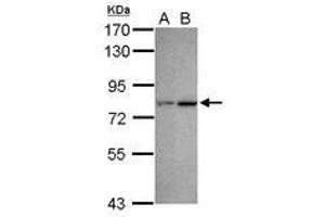Image no. 3 for anti-Chromodomain Protein, Y-Like (CDYL) (AA 1-544) antibody (ABIN1497464)