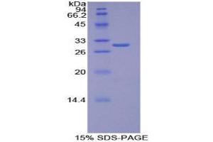 Image no. 1 for Torsin Family 1, Member B (Torsin B) (TOR1B) (AA 98-327) protein (His tag) (ABIN1877455)