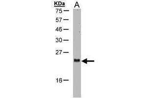 WB Image Sample(30 μg of whole cell lysate) A:H1299 15% SDS PAGE antibody diluted at 1:1000