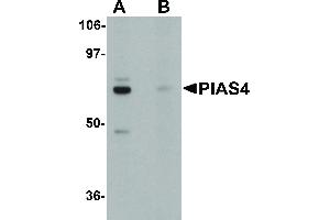 Image no. 1 for anti-Protein Inhibitor of Activated STAT, 4 (PIAS4) (N-Term) antibody (ABIN6656303)