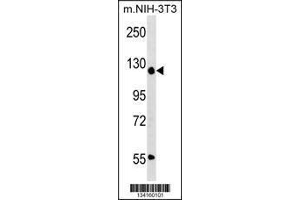anti-Activity-Dependent Neuroprotector Homeobox (ADNP) (AA 831-860), (C-Term) antibody