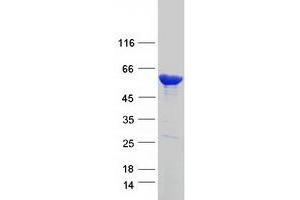 Image no. 1 for Carboxylesterase 1 (CES1) (Transcript Variant 2) protein (Myc-DYKDDDDK Tag) (ABIN2713928)