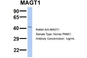 Image no. 1 for anti-Magnesium Transporter 1 (MAGT1) (N-Term) antibody (ABIN2787803)