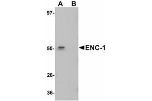 Image no. 1 for anti-Ectodermal-Neural Cortex 1 (With BTB-Like Domain) (ENC1) (Internal Region) antibody (ABIN478273)
