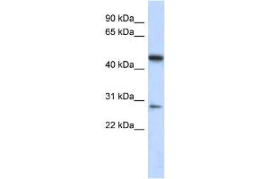 anti-Chromosome 13 Open Reading Frame 31 (C13orf31) (Middle Region) antibody