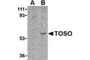 Image no. 1 for anti-Fas Apoptotic Inhibitory Molecule 3 (FAIM3) (C-Term) antibody (ABIN501016)