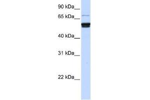 Western Blot showing ZNF93 antibody used at a concentration of 1-2 ug/ml to detect its target protein.