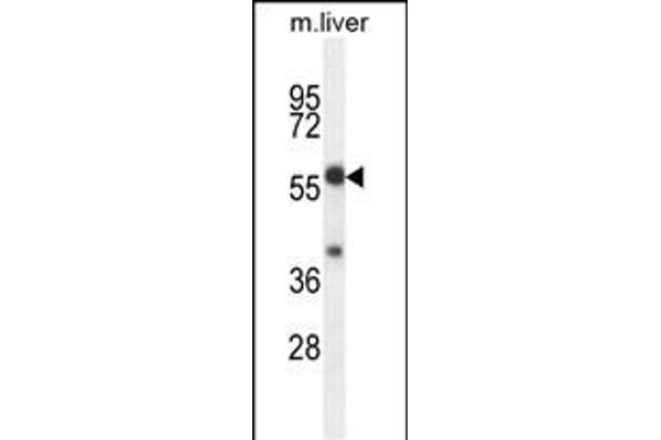 TBCCD1 抗体  (C-Term)