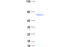 Image no. 1 for DNA (Cytosine-5-)-Methyltransferase 3 Like (TRDMT1) protein (DYKDDDDK Tag) (ABIN2719620)