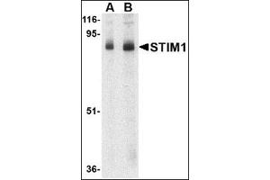 Image no. 2 for anti-Stromal Interaction Molecule 1 (STIM1) (C-Term) antibody (ABIN500827)
