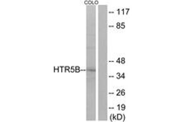 anti-5-Hydroxytryptamine (serotonin) Receptor 5B (HTR5B) (AA 280-329) antibody