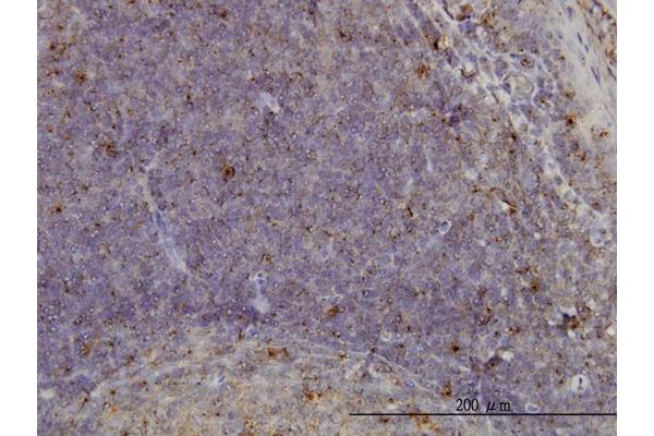 anti-MCF.2 Cell Line Derived Transforming Sequence-Like (MCF2L) (AA 220-319) antibody