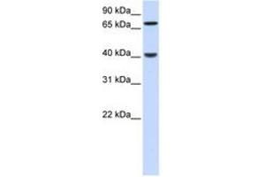 Image no. 1 for anti-PDZ and LIM Domain 3 (PDLIM3) (N-Term) antibody (ABIN6741278)