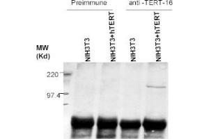 Image no. 4 for anti-Telomerase Reverse Transcriptase (TERT) (C-Term) antibody (ABIN6655270)