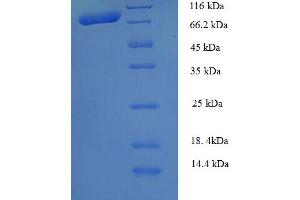 CAPN1 Protein (AA 1-714, full length) (His tag)