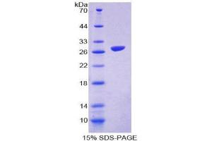 Image no. 1 for Signal-Regulatory Protein beta 1 (SIRPB1) (AA 129-342) protein (His tag) (ABIN2126756)