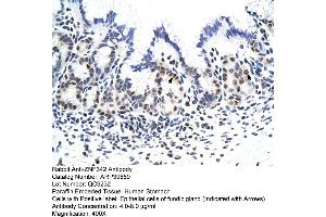 Image no. 3 for anti-Zinc Finger Protein 296 (ZNF296) (C-Term) antibody (ABIN2778483)