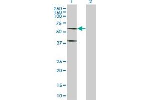 Image no. 1 for anti-Adenosylhomocysteinase-Like 1 (AHCYL1) (AA 1-530) antibody (ABIN524190)