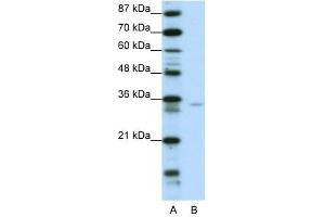 Western Blot showing ZNF177 antibody used at a concentration of 1-2 ug/ml to detect its target protein.