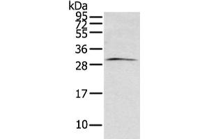 ZFAND2B anticorps