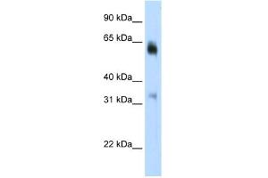 JMJD2D Antikörper  (C-Term)