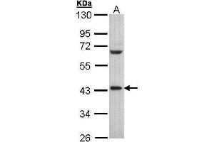 Image no. 2 for anti-Poly(rC) Binding Protein 2 (PCBP2) (C-Term) antibody (ABIN2856597)