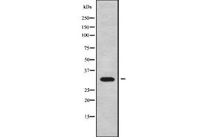 Image no. 2 for anti-Cerebellar Degeneration-Related Protein 1, 34kDa (CDR1) (N-Term) antibody (ABIN6260730)