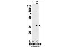 Image no. 1 for anti-Major Histocompatibility Complex, Class II, DQ alpha 1 (HLA-DQA1) (AA 39-66), (N-Term) antibody (ABIN656108)