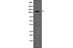 Image no. 1 for anti-Solute Carrier Family 12 (Potassium-Chloride Transporter) Member 2 (SLC12A2) (Internal Region) antibody (ABIN6258568)