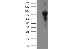Image no. 1 for anti-Vascular Cell Adhesion Molecule 1 (VCAM1) antibody (ABIN1497154)