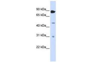 Image no. 1 for anti-Adenosine Deaminase, RNA-Specific, B1 (ADARB1) (N-Term) antibody (ABIN6742969)