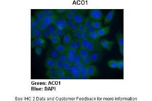 Image no. 7 for anti-Aconitase 1 (ACO1) (N-Term) antibody (ABIN2778793)