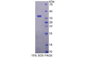 Image no. 1 for Pyridoxamine 5'-Phosphate Oxidase (PNPO) (AA 1-261) protein (His tag) (ABIN6238809)