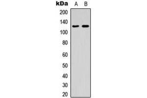 Image no. 1 for anti-Suppression of Tumorigenicity 5 (ST5) (Center) antibody (ABIN2707104)