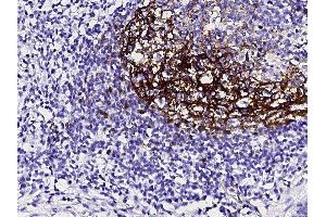 Image no. 1 for anti-Fc Fragment of IgE, Low Affinity II, Receptor For (CD23) (FCER2) (AA 48-321) antibody (ABIN2649195)