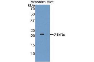 Image no. 1 for anti-ADAM Metallopeptidase with thrombospondin Type 1 Motif, 12 (ADAMTS12) (AA 823-997) antibody (ABIN1857900)