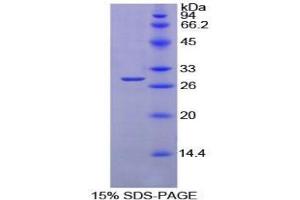 Image no. 1 for Protein tyrosine Phosphatase, Receptor Type, S (PTPRS) protein (ABIN3011382)