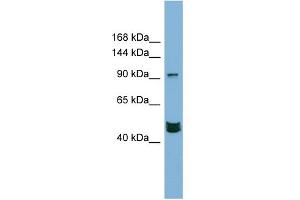Image no. 1 for anti-Mastermind-Like 3 (MAML3) (Middle Region) antibody (ABIN2783063)