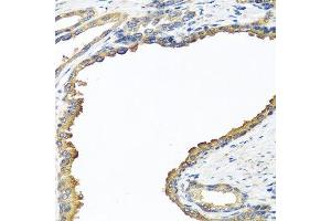Image no. 3 for anti-Nyctalopin (NYX) antibody (ABIN6144979)