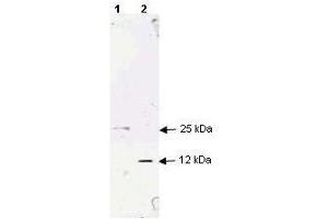 Image no. 2 for anti-Transforming Growth Factor, beta 1 (TGFB1) antibody (ABIN107740)