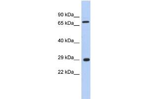 Image no. 1 for anti-AKT Interacting Protein (AKTIP) (Middle Region) antibody (ABIN2786570)