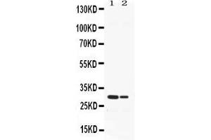 Image no. 3 for anti-Elastase, Neutrophil Expressed (ELANE) (AA 27-265) antibody (ABIN4886568)