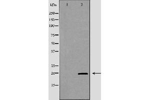 Image no. 1 for anti-Killer Cell Lectin-Like Receptor Subfamily D, Member 1 (KLRD1) antibody (ABIN6262856)
