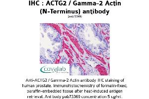 Image no. 2 for anti-Actin, gamma 2, Smooth Muscle, Enteric (ACTG2) antibody (ABIN1731474)