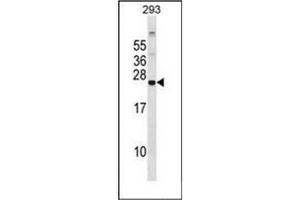 Image no. 1 for anti-Glutathione Peroxidase 8 (GPX8) (AA 163-192), (C-Term) antibody (ABIN952542)