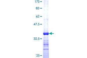 Image no. 1 for Polymerase (DNA-Directed), epsilon 4 (p12 Subunit) (POLE4) (AA 31-117) protein (GST tag) (ABIN1315640)