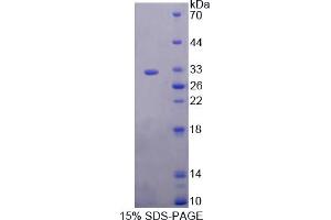 Image no. 1 for Kallikrein 2 (KLK2) (AA 19-261) protein (His tag) (ABIN6236957)