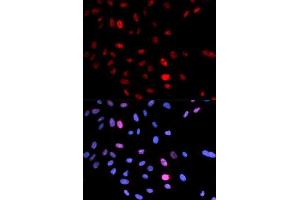 Image no. 5 for anti-Structural Maintenance of Chromosomes 1A (SMC1A) (pSer957) antibody (ABIN3019554)